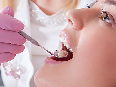 Granger Dentistry | Teeth Whitening, Dental Sealants and Sedation Dentistry