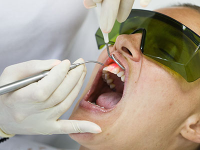 Granger Dentistry | Oral Exams, Root Canals and ClearCorrect reg 
